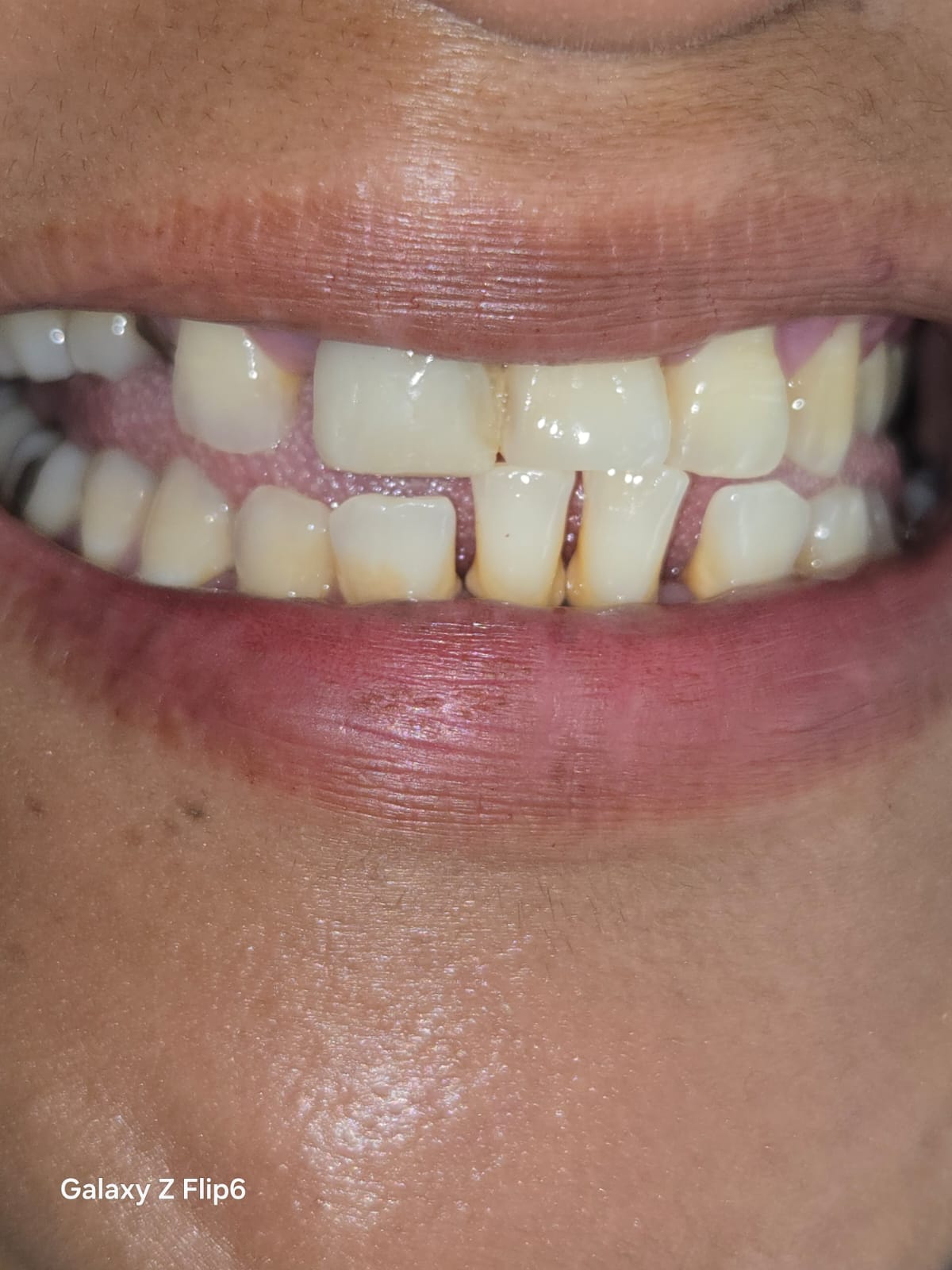 Trabajo del Dr. Armando Frutos