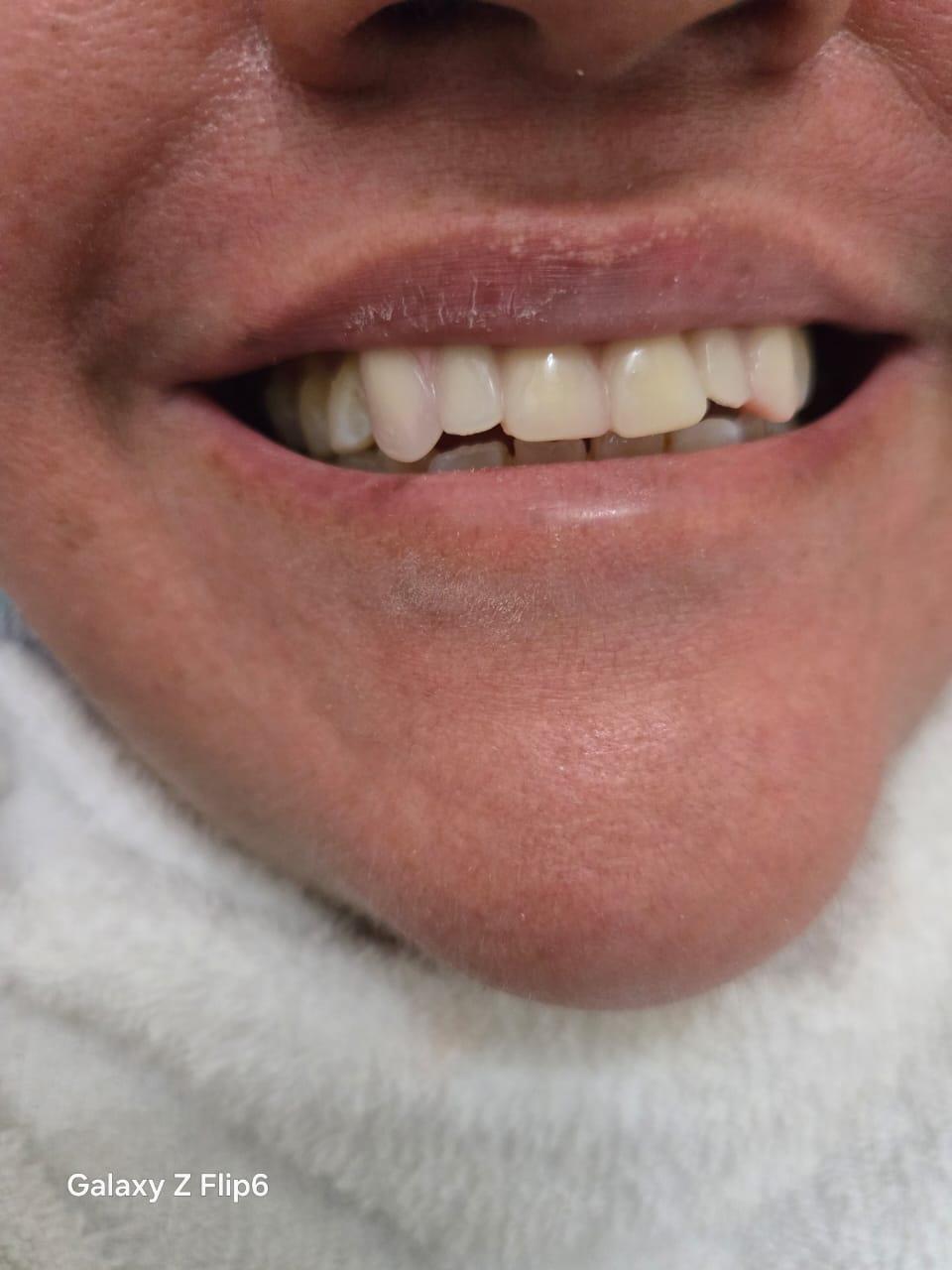 Trabajo del Dr. Armando Frutos